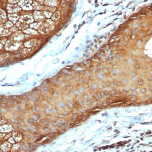 Formalin-fixed, paraffin-embedded human skin stained with CK Type I Recombinant Mouse Monoclonal Antibody (rKRTL/6616).