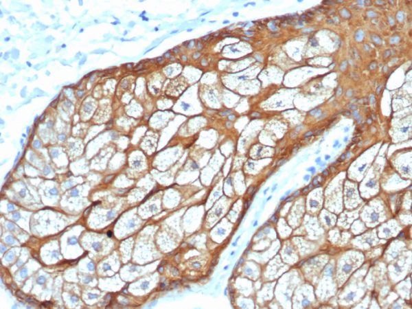 Formalin-fixed, paraffin-embedded human sebaceous gland stained with CK Type II Recombinant Mouse Monoclonal Antibody (rKRTH/6617).