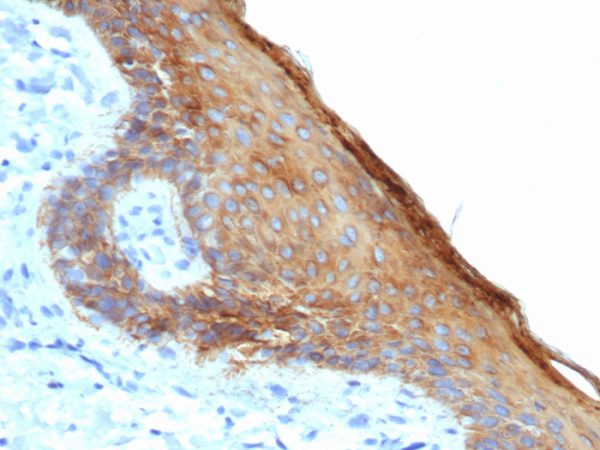 Formalin-fixed, paraffin-embedded human skin stained with CK Type II Recombinant Mouse Monoclonal Antibody (rKRTH/6617).
