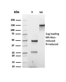 SDS-PAGE Analysis Purified CK Type 2 Recombinant Mouse Monoclonal (rKRTH/6617). Confirmation of Purity and Integrity of Antibody.