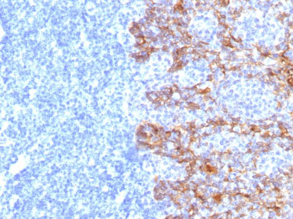 Formalin-fixed, paraffin-embedded human Tonsil stained with Cytokeratin, LMW Monoclonal Antibody (SPM115)