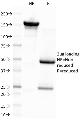SDS-PAGE Analysis Purified EBV Mouse Monoclonal Antibody (CS4). Confirmation of Integrity and Purity of Antibody.