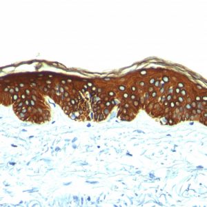 Formalin-fixed, paraffin-embedded human skin stained with Cytokeratin, HMW Mouse Monoclonal Antibody (AE-3).