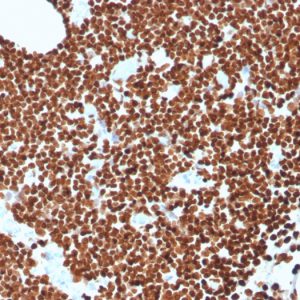 Formalin-fixed, paraffin-embedded human lymph node stained with dsDNA Recombinant Mouse Monoclonal Antibody (rDSD/4565).