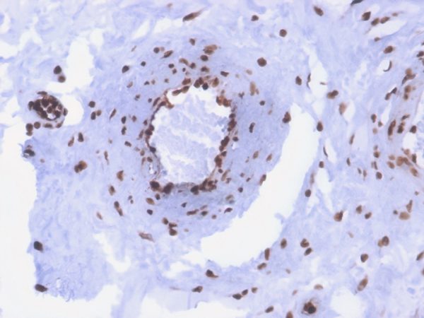 Formalin-fixed, paraffin-embedded human colon stained with dsDNA Recombinant Mouse Monoclonal Antibody (rDSD/4565).
