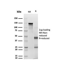 SDS-PAGE Analysis of Purified Pan CK Recombinant Mouse Monoclonal Antibody (rPCK/6750). Confirmation of Purity and Integrity of Antibody.