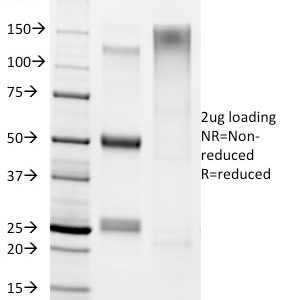SDS-PAGE Analysis of Purified Helicobacter pylori Mouse Monoclonal Antibody (HP/1336). Confirmation of Integrity and Purity of antibody.