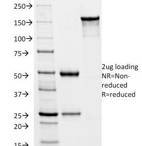 SDS-PAGE Analysis of Purified HSVI Mouse Monoclonal Antibody (HSVI/2045). Confirmation of Integrity and Purity