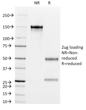 SDS-PAGE Analysis Purified Cytokeratin 8/18 Monoclonal Antibody (K8.8 + DC10). Confirmation of Purity and Integrity of Antibody.