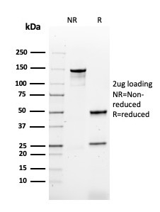 SDS-PAGE Analysis Purified HPV-16 Mouse Recombinant Monoclonal Antibody (rHPV16L1/1058). Confirmation of Purity and Integrity of Antibody.