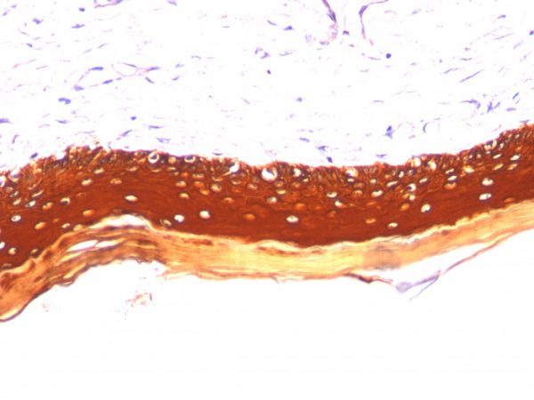 Formalin-fixed, paraffin-embedded human Skin stained with Cytokeratin, LMW Monoclonal Antibody (KRTL/1077).