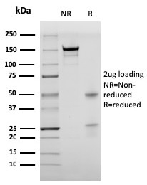 SDS-PAGE Analysis of Purified BrdU Mouse Recombinant Monoclonal Antibody (rBRD469). Confirmation of Purity and Integrity of Antibody.