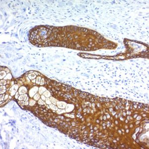 Formalin-fixed, paraffin-embedded human Skin stained with Cytokeratin, HMW Monoclonal Antibody (KRTH/1076).