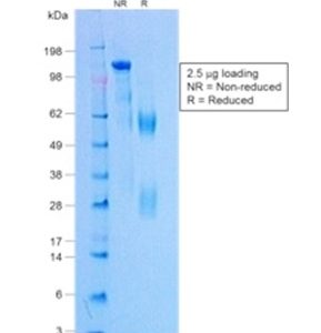 SDS-PAGE Analysis of Purified Negative Control for Rabbit Monoclonal Abs (NCRBM/1520R). Confirmation of Purity and Integrity of Antibody.