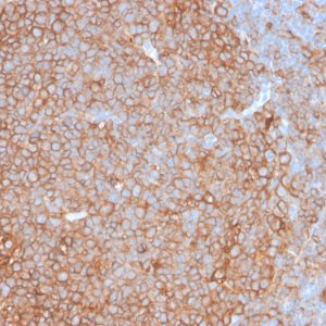 Formalin-fixed, paraffin-embedded human tonsil stained with HLA-Pan Rabbit Recombinant Monoclonal Antibody (HLA-Pan/2967R).