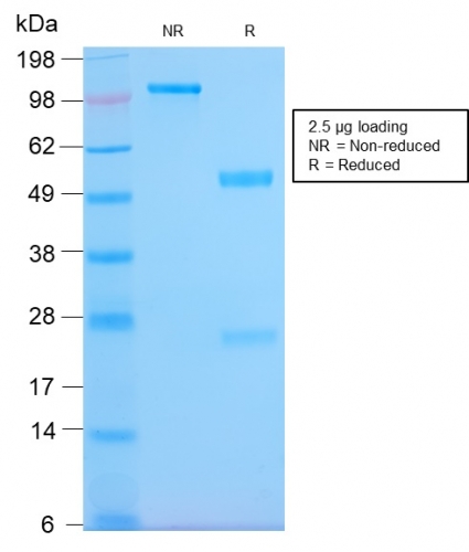 SDS-PAGE Analysis Purified HLA-Pan Rabbit Recombinant Monoclonal (HLA-Pan/2967R). Confirmation of Purity and Integrity of Antibody.