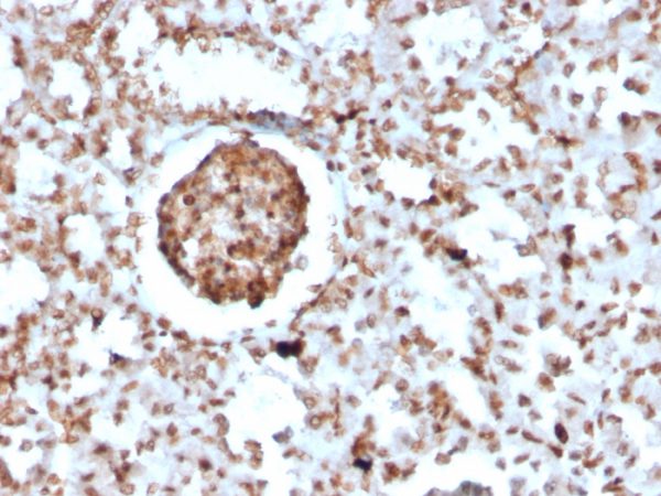 Formalin-fixed, paraffin-embedded Mouse BrdU-incorporated Kidney stained with BrdU Rabbit Recombinant Monoclonal Antibody (BRD2888R).