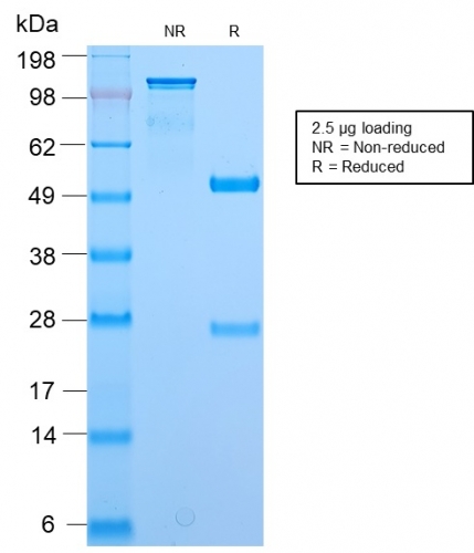 SDS-PAGE Analysis Purified BrdU Rabbit Recombinant Monoclonal Antibody (BRD2888R). Confirmation of Purity and Integrity of Antibody.