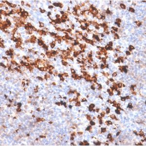 Formalin-fixed, paraffin-embedded Tonsil stained with biotinylated Kappa Light Chain probe followed by anti-biotin Rabbit Recombinant Monoclonal antibody (BTN/2032R).