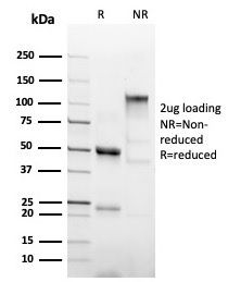 SDS-PAGE Analysis Purified Anti-Hexa-Histidine Recombinant Rabbit Monoclonal 6HIS/6402R). Confirmation of Integrity and Purity of Antibody.
