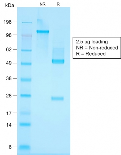 SDS-PAGE Analysis Purified Cytokeratin, HMW Rabbit Recombinant Monoclonal Antibody (KRTH/1576R).