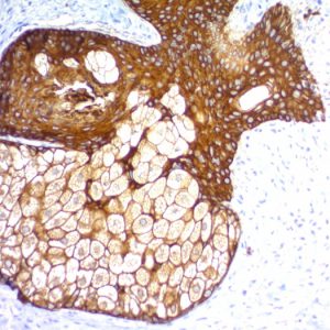 Formalin-fixed, paraffin-embedded human Skin stained with Pan-Cytokeratin Recombinant Rabbit Monoclonal Antibody (KRTH/1576R + KRTL/1577R).