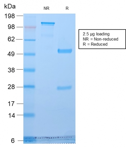 SDS-PAGE Analysis Purified Golgi Rabbit Recombinant Monoclonal Antibody (GLG1/2829R). Confirmation of Purity and Integrity of Antibody.