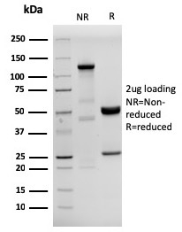 SDS-PAGE Analysis Purified HHV8 Recombinant Rabbit Monoclonal Antibody (HHV8/3633R). Confirmation of Purity and Integrity of Antibody.