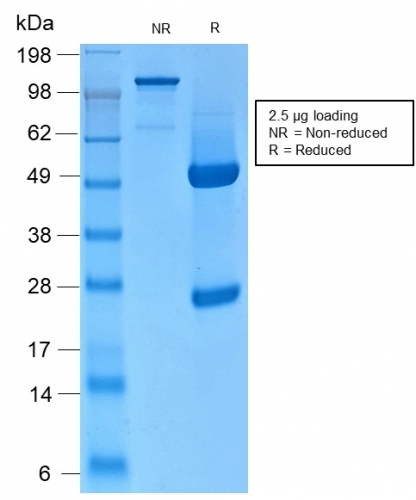 SDS-PAGE Analysis of Purified CK HMW Rabbit Recombinant Monoclonal Antibody (KRTH/2147R). Confirmation of Integrity and Purity of Antibody.