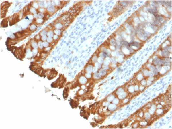 Formalin fixed paraffin embedded human colon stained with Cytokeratin 8/18 Rabbit Recombinant Monoclonal Antibody (KRT8.18/2297R).