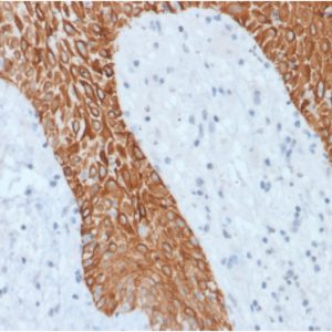 Formalin-fixed, paraffin-embedded human Skin stained with Multi-Cytokeratin Recombinant Rabbit Monoclonal Antibody (KRT/1877R).