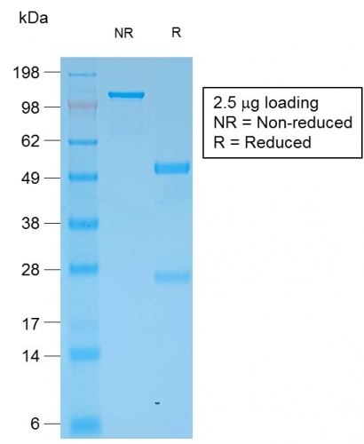 SDS-PAGE Analysis Purified Multi-Cytokeratin Rabbit Monoclonal Antibody (KRT/1877R). Confirmation of Integrity and Purity of Antibody.