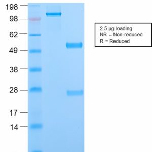 SDS-PAGE Analysis of Purified Phosphotyrosine Rabbit Recombinant Monoclonal Ab (PY2870R). Confirmation of Purity and Integrity of Antibody.