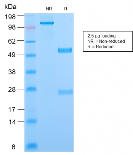 SDS-PAGE Analysis Purified Phosphotyrosine Rabbit Recombinant Monoclonal Ab (PY2870R). Confirmation of Purity and Integrity of Antibody.