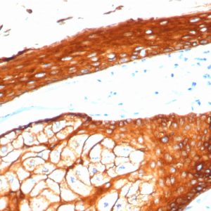 Formalin-fixed, paraffin-embedded human skin stained with CK Type II Recombinant Rabbit Monoclonal Antibody (KRTH/4392R).