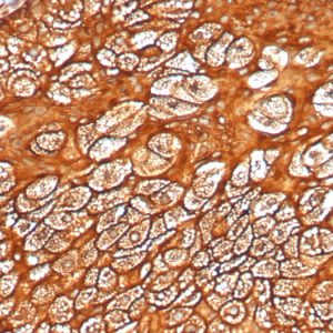 Formalin-fixed, paraffin-embedded human skin stained with CK Type I Recombinant Rabbit Monoclonal Antibody (KRTL/4440R).