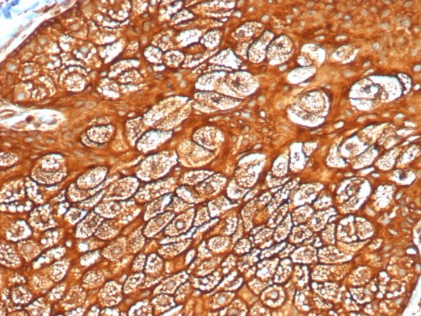 Formalin-fixed, paraffin-embedded human skin stained with CK Type I Recombinant Rabbit Monoclonal Antibody (KRTL/4440R).
