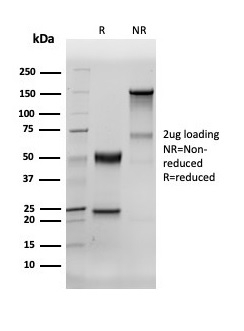 SDS-PAGE Analysis Purified HNA Recombinant Rabbit Monoclonal Antibody (235-1R). Confirmation of Integrity and Purity of the Antibody.