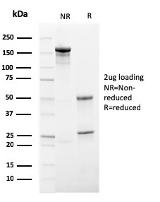 SDS-PAGE Analysis Purified HSV1 Recombinant Rabbit Monoclonal Antibody (HSV1/4055R). Confirmation of Purity and Integrity of Antibody.