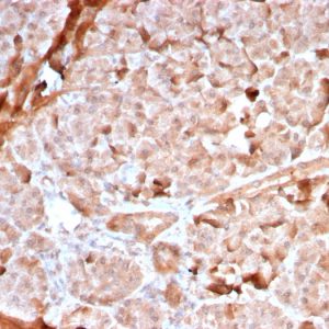 Recombinant Mitochondria (Marker for Human Cells, Granular RCC's & Salivary Tumors) Antibody