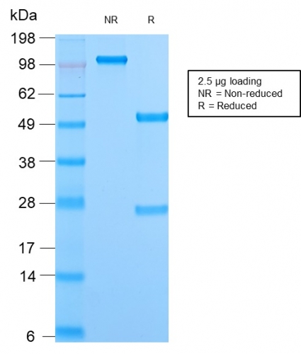 SDS-PAGE Analysis Purified Mitochondria Rabbit Recombinant Monoclonal (MTC02/2860R). Confirmation of Purity and Integrity of Antibody.