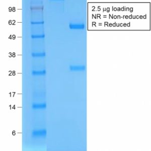 SDS-PAGE Analysis of Purified BrdU Rabbit Recombinant Monoclonal Antibody (BRD/1539R). Confirmation of Purity and Integrity of Antibody.