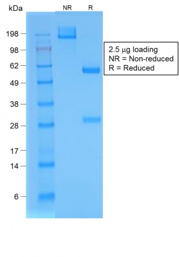 SDS-PAGE Analysis Purified BrdU Rabbit Recombinant Monoclonal Antibody (BRD/1539R). Confirmation of Purity and Integrity of Antibody.