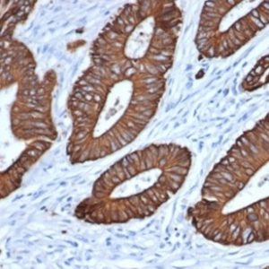 Formalin-fixed, paraffin-embedded human colon stained with Pan-Cytokeratin Recombinant Rabbit MonoPoly Antibody (MonoPoly/7249R).