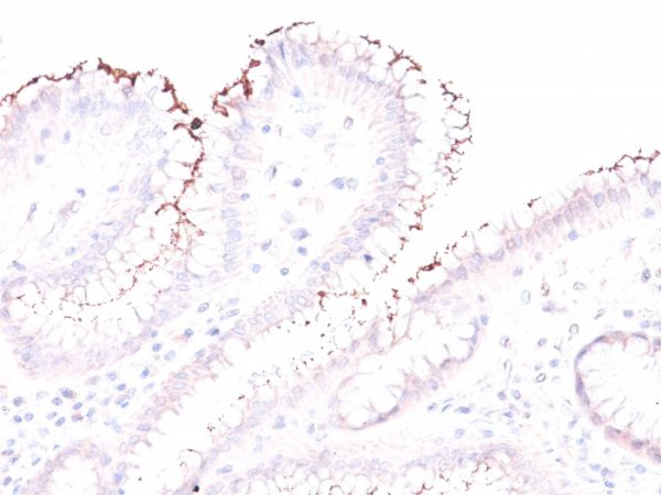 Formalin-fixed, paraffin-embedded human Stomach stained with Helicobacter pylori Rabbit PAb.