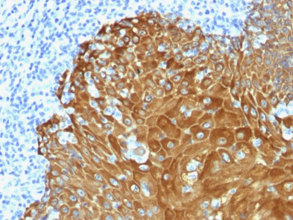 Formalin-fixed, paraffin-embedded human Skin stained with Pan-Cytokeratin Rabbit Polyclonal Antibody.
