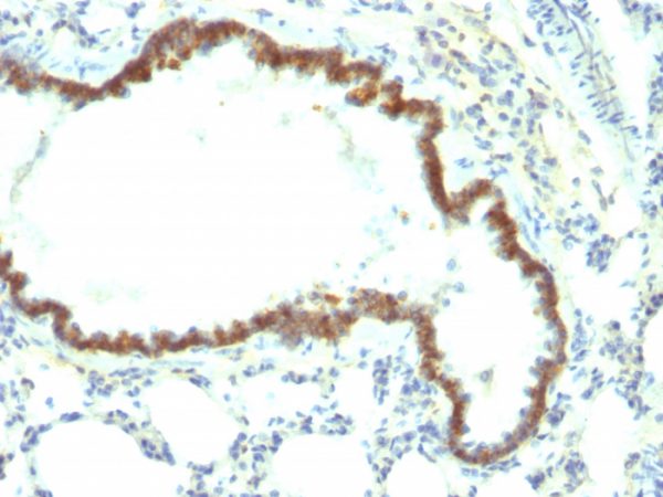 Formalin-fixed, paraffin-embedded Rat Lung stained with Ep-CAM Monoclonal Antibody (Epcam/1158).