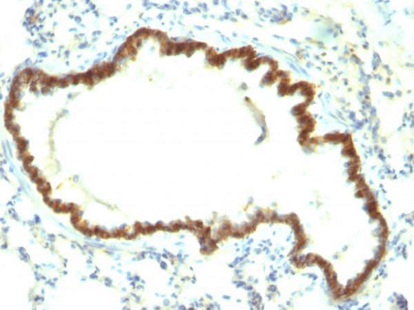 Formalin-fixed, paraffin-embedded Rat Lung stained with Ep-CAM Monoclonal Antibody (Epcam/1159).