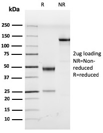 SDS-PAGE Analysis of Purified HHV8 Rat Monoclonal Antibody (LN53). Confirmation of Purity and Integrity of Antibody.