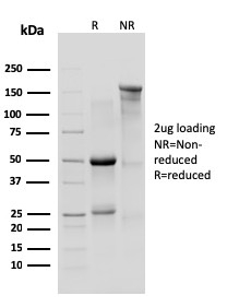 SDS-PAGE Analysis of Purified IL-10R1 Rat Monoclonal Antibody (1B1.3a). Confirmation of Integrity and Purity of Antibody.